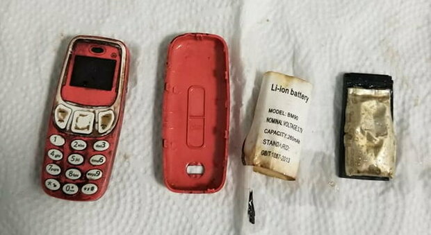 Nokia 3310 ingoiato intero, il telefonino estratto dopo 4 giorni: è intatto