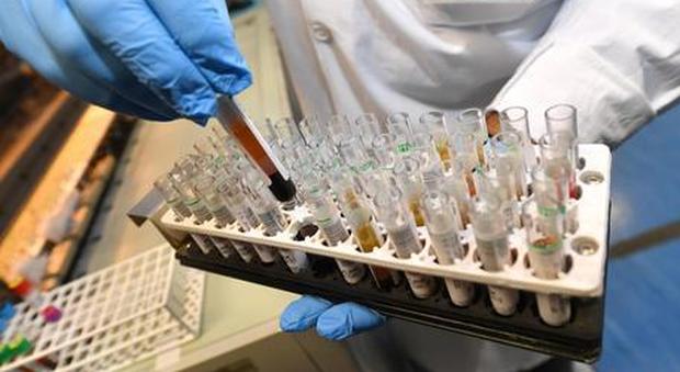 Coronavirus, gli studiosi: «Allarme falsi negativi nei tamponi» Coronavirus, gli studiosi: «Allarme falsi negativi nei tamponi»
