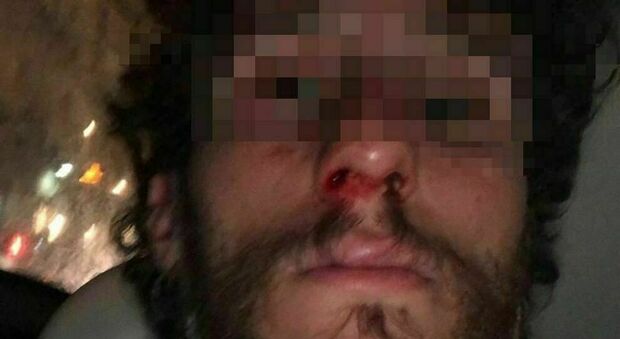 Aggressione omofoba nella piazza di Napoli: insultato e picchiato da dieci persone Aggressione omofoba nella piazza di Napoli: insultato e picchiato da dieci persone