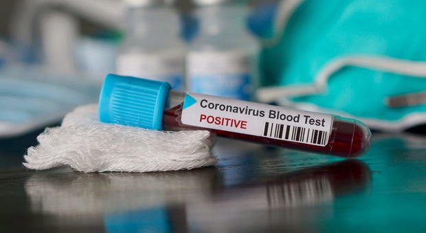 Coronavirus a Roma, Spallanzani: «Ricoverati 60 pazienti positivi, 10 con supporto respiratorio»