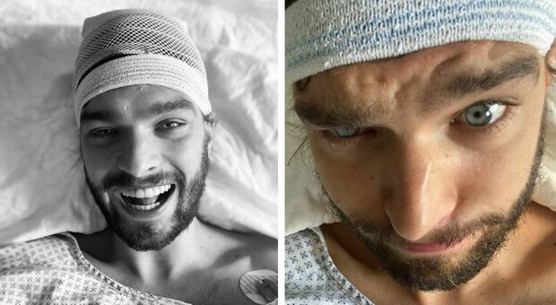 L'attore, 27 anni, lo scrive in un post su Instagram dall'ospedale, mostrandosi sorridente in una foto con la testa fasciata