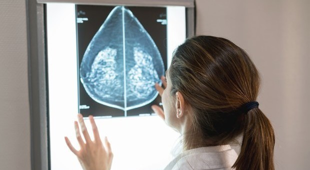 Tumore al seno, un nuovo farmaco al posto della chemio: il via libera dell'Aifa all'abemaciclib