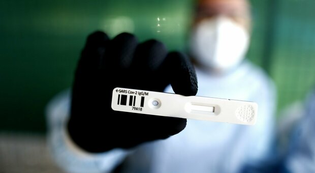 Coronavirus Lazio, 15 casi di cui 9 di importazione: un morto Coronavirus Lazio, 15 casi di cui 9 di importazione: un morto