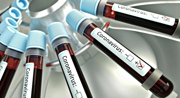 Il farmaco contro la gotta sperimentato sui malati di coronavirus: il sì dell'Aifa