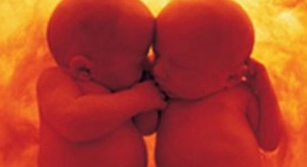 Salvati gemellini abbracciati nel grembo della mamma affetta da tumore