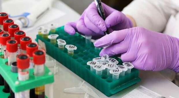 Coronavirus, positivo ragazzo tornato dalle vacanze a Malta Coronavirus, positivo ragazzo tornato dalle vacanze a Malta
