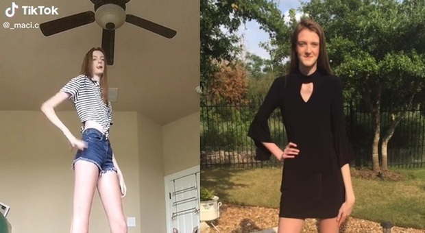 Guinness, la ragazza con le gambe più lunghe del mondo su Onlyfans: «Anche l'altezza può essere sexy»