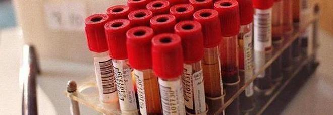 Coronavirus, paziente al Pronto soccorso di Atessa: test negativo