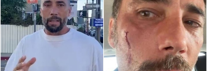 Vittorio Brumotti rapinato a Los Angeles dove era in vacanza: «Mi hanno messo una pistola in bocca»