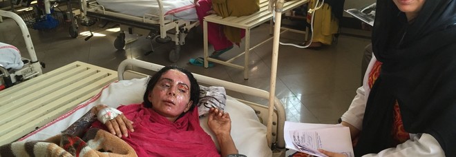 Un medico italiano ha ridato un volto a 200 donne sfigurate con l'acido dal proprio marito