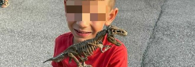 Padova, bambino di 6 anni morto in 10 giorni: leucemia fulminante