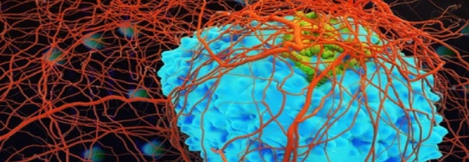 Tumori, lo studio sul virus dell'herpes: così è in grado di distruggere le cellule cancerose
