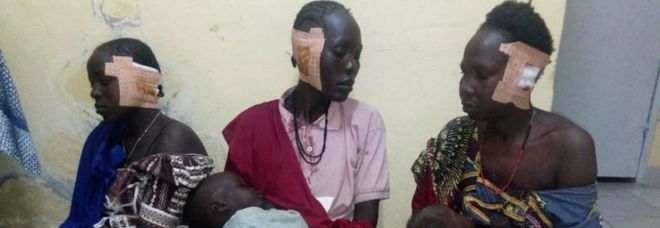 Le donne mutilate dei terroristi in Camerun