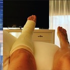 Mara Venier si è rotta il piede: «Una bella frattura». La foto ingessata dall'ospedale