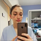 Coronavirus, l'appello di Alessia l'infermiera con i segni della maschera: «Sono stanca ma faccio la mia parte, voi fate la vostra»