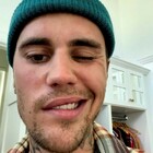 Justin Bieber e la paralisi facciale. Colpa del vaccino Covid? L'esperto risponde così