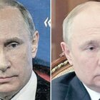 Putin è malato? Ipotesi «rabbia da steroidi»: ecco di cosa si tratta